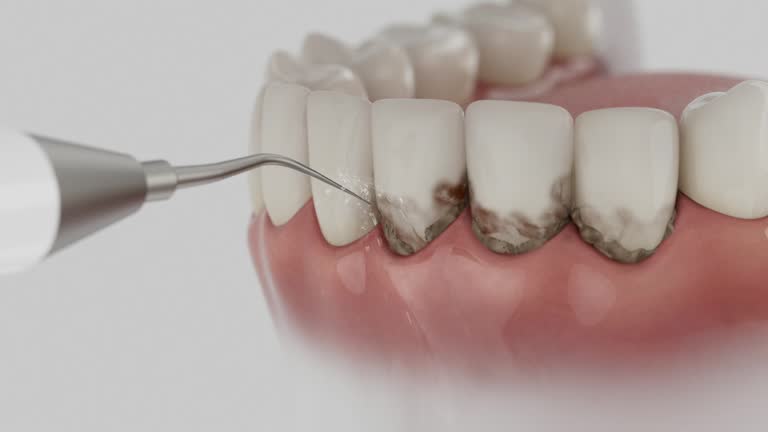 Trusted Invisalign Clear Aligners service in DeLisle, MS - Dentist Open Now